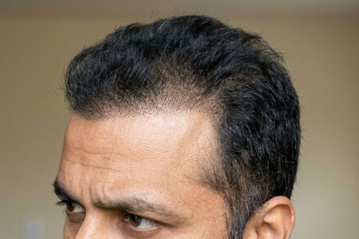 After treatment